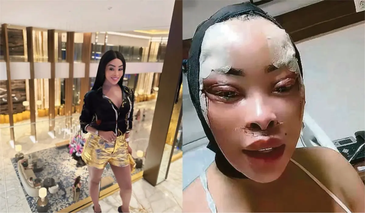 Khanyi Mbau Opens Up About Her Latest Cosmetic Surgery